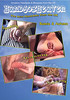 Video On Demand