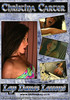 Video On Demand