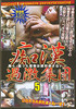 Video On Demand