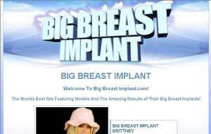 big-breast-implant