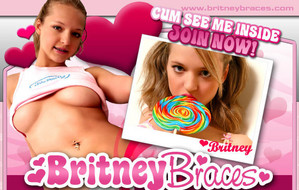 britney-braces