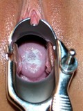 Slender girl gets totally nude then doctor examines her shaved pussy with speculum