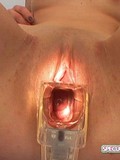 Man inserts speculum in brunette's pussy and examines her love tunnel after dildo play